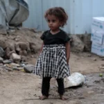 AA 20260918 42500499 42500498 HUNDREDS OF DISPLACED FAMILIES STRUGGLE UNDER HARSH CONDITIONS IN YEMEN